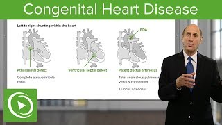 Congenital Heart Disease - Cardiology | Lecturio