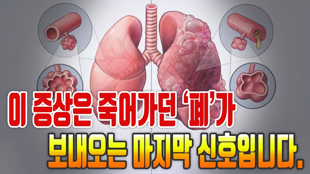 이 증상은 죽어가던 '폐'가 보내오는 마지막 신호입니다.