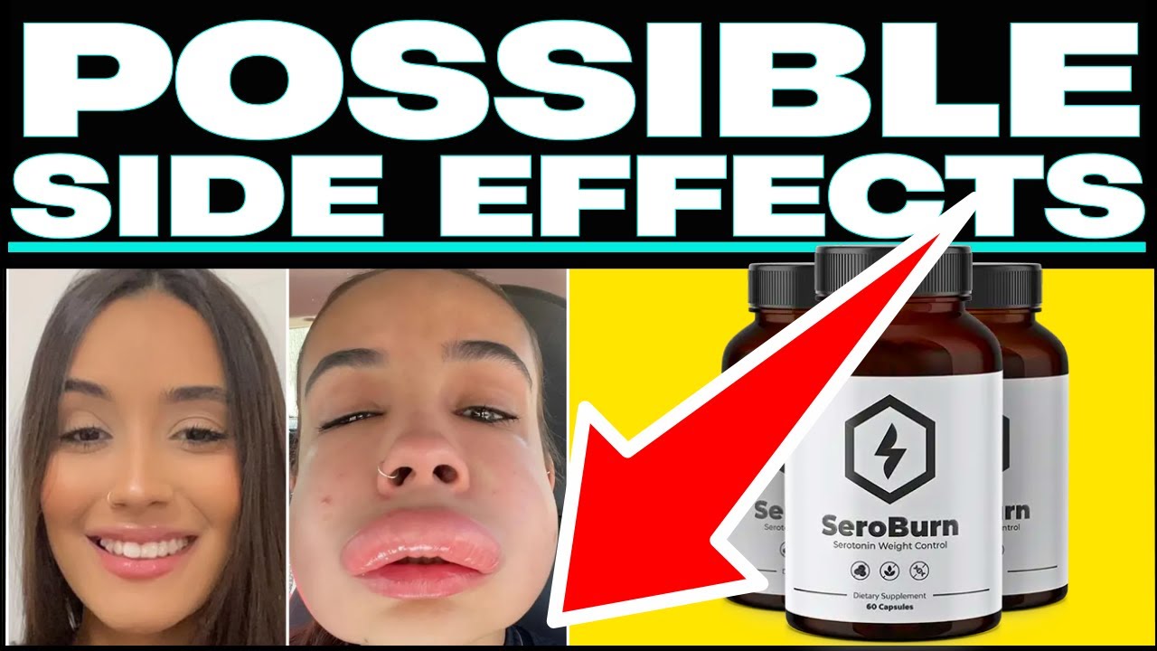 (😱❌BEWARE⛔🙀Get Your FREE Bottle Of SeroBurn? #seroburncom #seroburnreviews #seroburn #seroburnreview