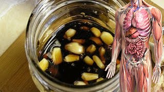 Përgatisni Kurën Me 4 Përbërës Dhe I Thoni Lamtumire Pagjumsise, Astmes, Dhimbjes Së Kokes