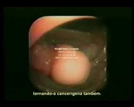 Video do intestino