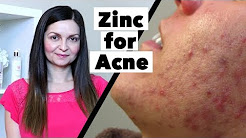 Zinc for Acne Treatment – How Much Zinc Supplement to Take for Clear Skin - Supplements for Acne
