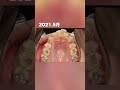 #shorts