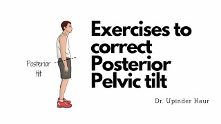 Exercises to correct Posterior pelvic tilt