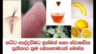කට්ට ඈද්දවීමට ඉක්මන් සහා ස්වාභවික ප්‍රතිකාර ක්‍රම How To Get A Splinter Out Naturally