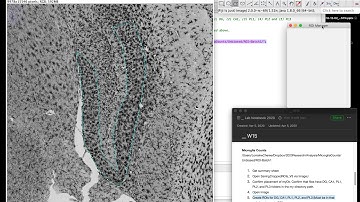 ImageJ protocol: LS 1 Creating ROIs