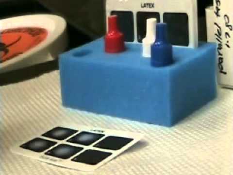 What Color Tube For In A Rheumatoid Arthritis Test