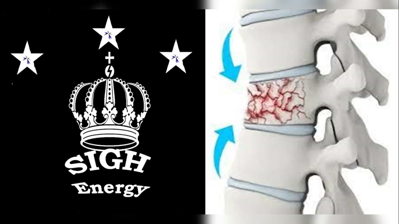 Spinal Compression Fractures Healing and Regeneration EXTREMELY