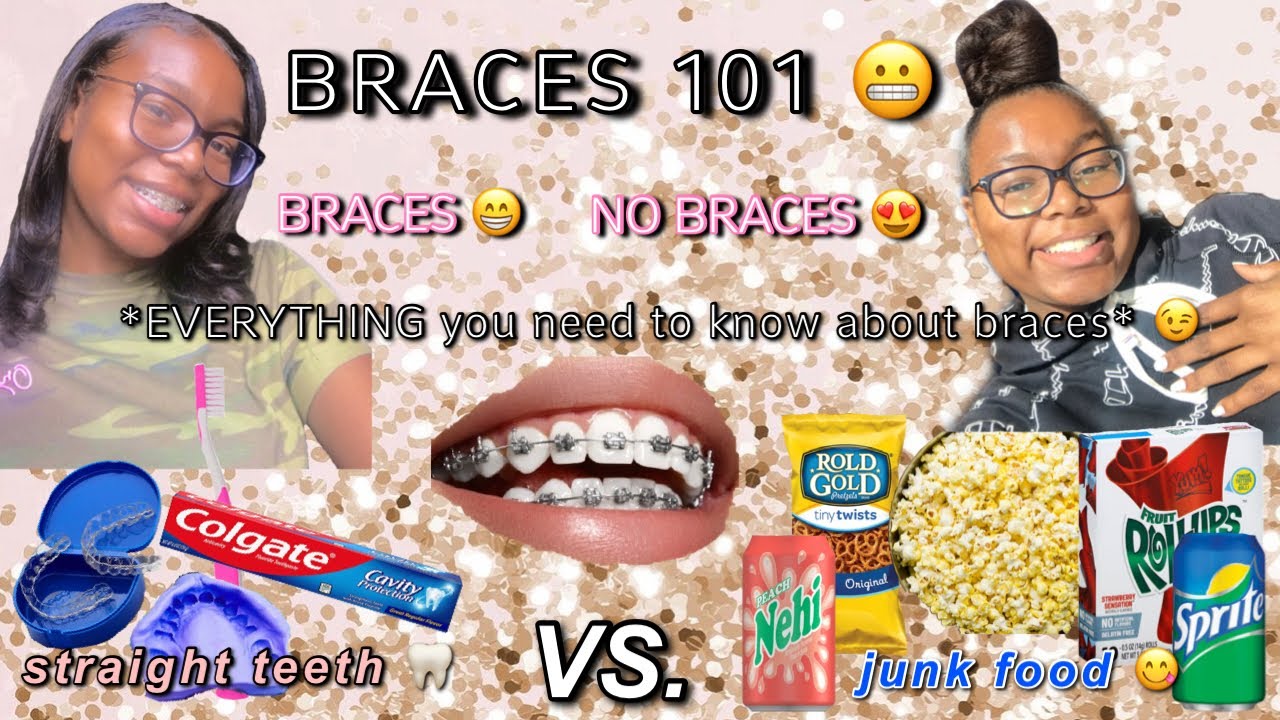 Braces 101 😬 (everything you need to know) 😉 - YouTube