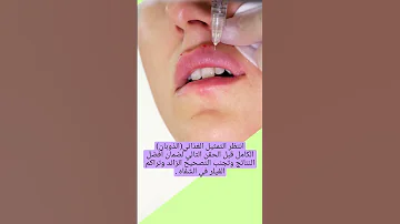 فهم مدة ومخاطر حقن الفيلر ما تحتاج إلى معرفته قبل حقن الشفايف Shorts Trending Facts 