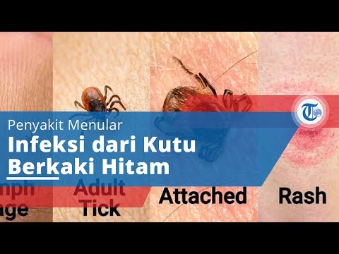 Video: Evaluasi Fluralaner Sebagai Acaricide Oral Untuk Mengurangi Serangan Kutu Di Reservoir Hewan Pengerat Penyakit Lyme