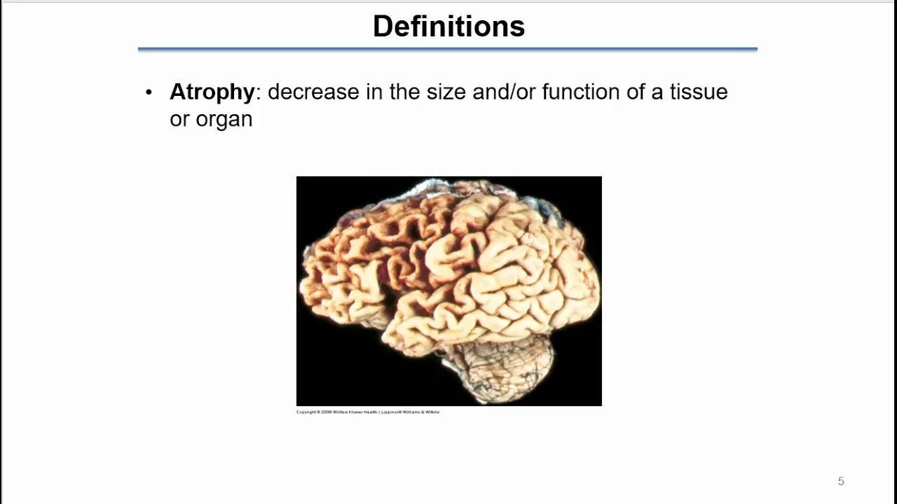Cellular adaptation: unit 2 - YouTube