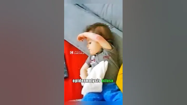 Mother runs to hug her son, who woke up from a 16-day coma #truestory#shorts