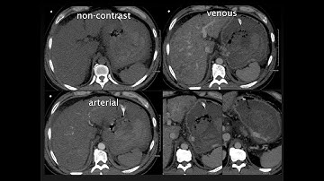 CT Protocol Essentials