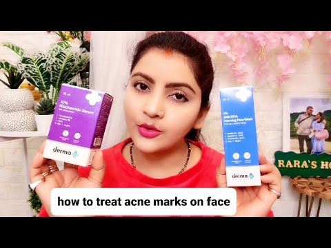 How to remove acne & acne marks on face | RARA | 3% AHA BHA FACEWASH & 10% NIACINAMIDE FACE SERUM