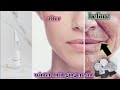 “Phitkari Anti-Aging Cream | Tight &amp; Glowing Skin Naturally!”#skincare #mycozydunia