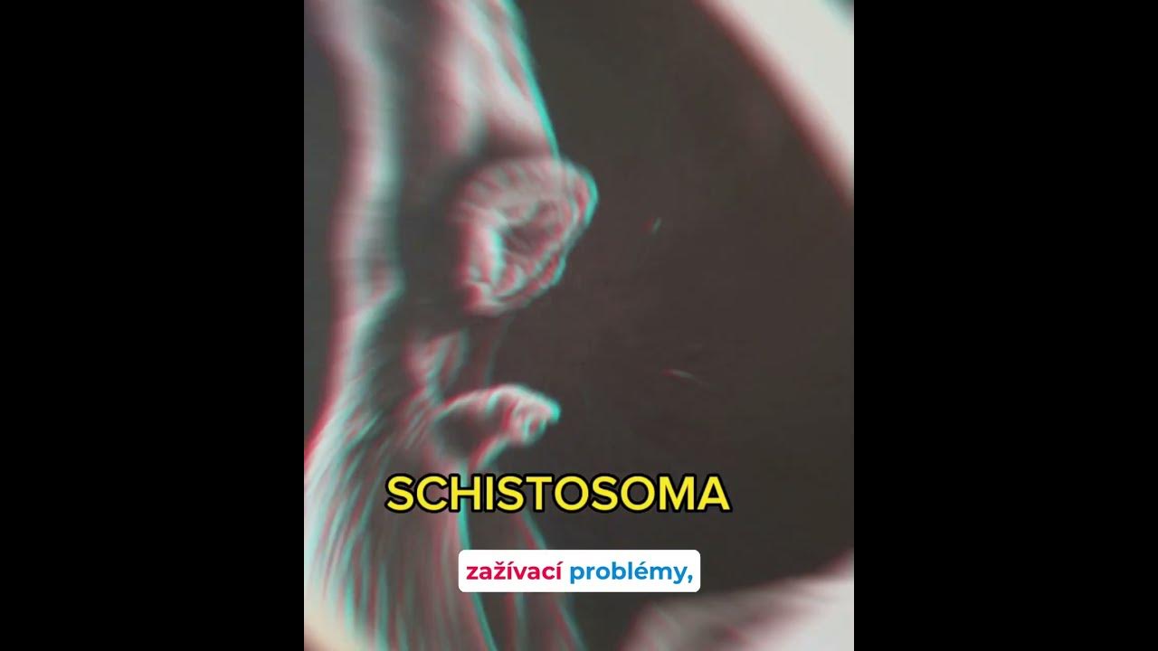Malý PARAZITI v nás.... - YouTube
