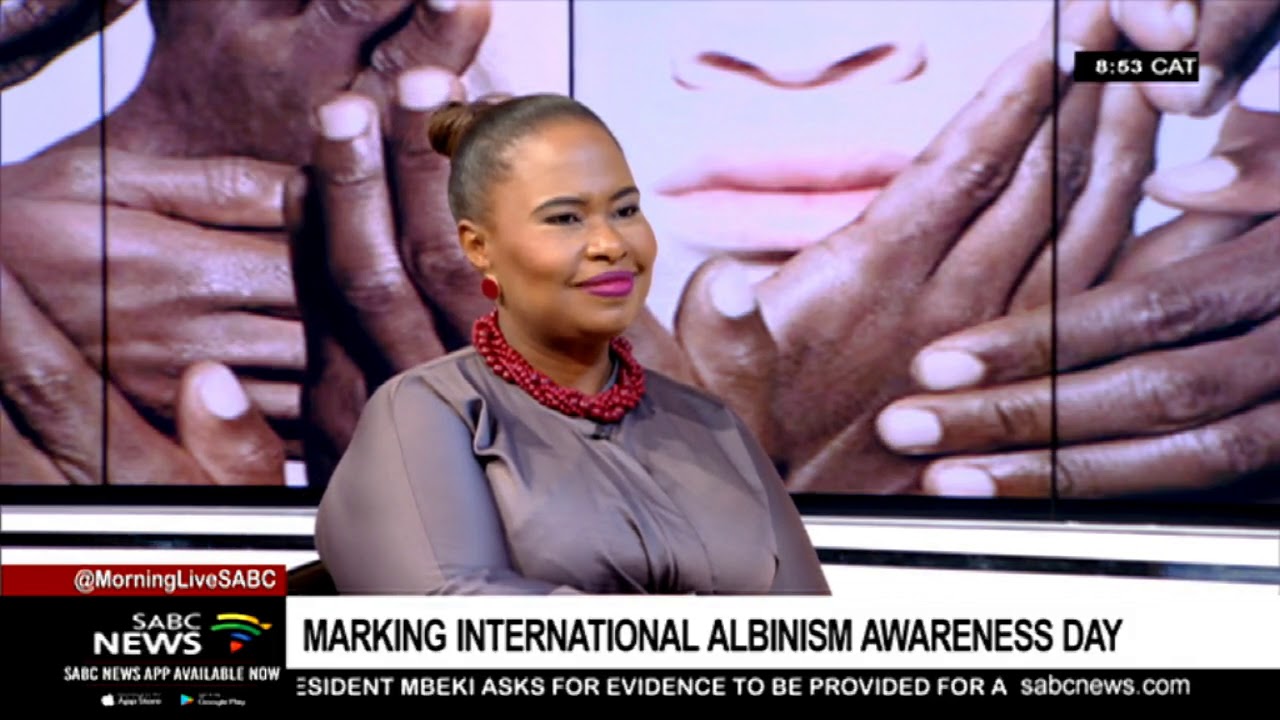 DISCUSSION: International Albinism Awareness Day