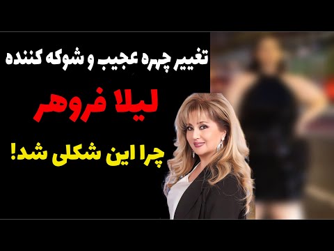 تغییر چهره عجیب و شوکه کننده لیلا فروهر چرا این شکلی شده