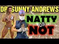 Dr. Sunny Andrews || Natty or Not???