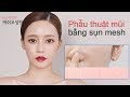 Phẫu thuật mũi đẹp tự nhiên tại bệnh viện ID