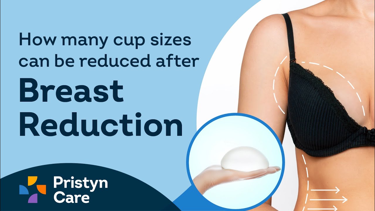 How many cup sizes can be reduced after Breast Reduction 