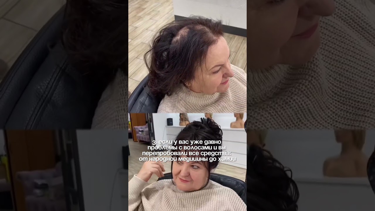 🤔А что, если решение ваших проблем с волосами уже рядом? 👉 @europehair.ru