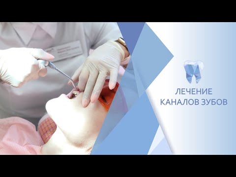 Лечение каналов зубов