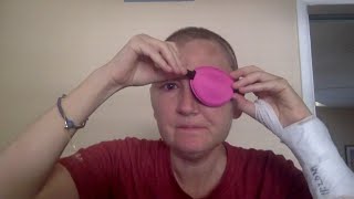 Post-op Orbital Exenteration & Cranial Surgery Losing My Eye and What's Next for Cancer Treatment