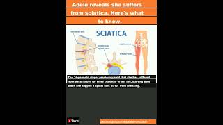 Adele reveals she suffers from sciatica. Here's what to know.|#shorts