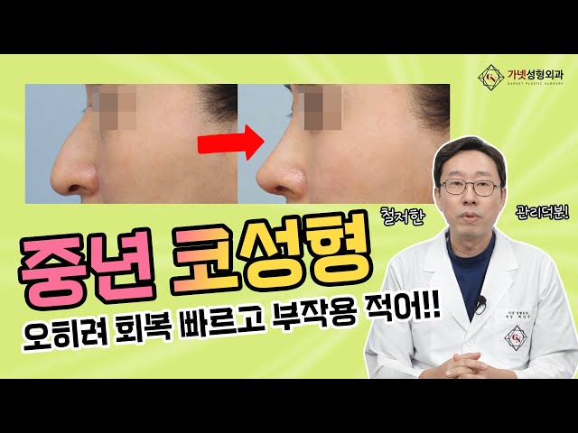 40대 50대 중년 코성형! 중년도 예쁘게 코수술 할수 있어❤️ 오히려 붓기, 멍 적고 회복이 빠르답니다👍