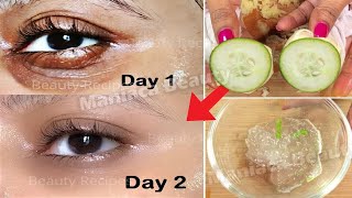 In 3 days how to Remove Under Eye WRINKLES, Remove Under Eye Bags Completely  Remove Dark Circle