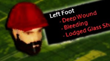 Can I survive in Project Zomboid as a Noob?