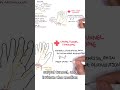Numbness in the thumb, index, and middle fingers? #clinicalanatomy #mediannerve #handanatomy