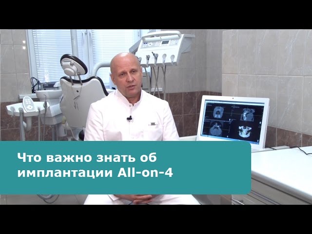 Что важно знать об All-on-4