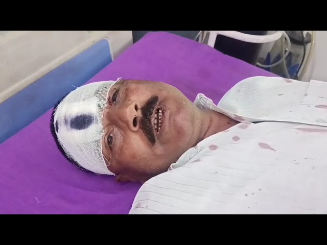 बुलंदशहर: बेटी से छेड़छाड़ का विरोध करने पर पिता पर हमला, हालत गंभीर