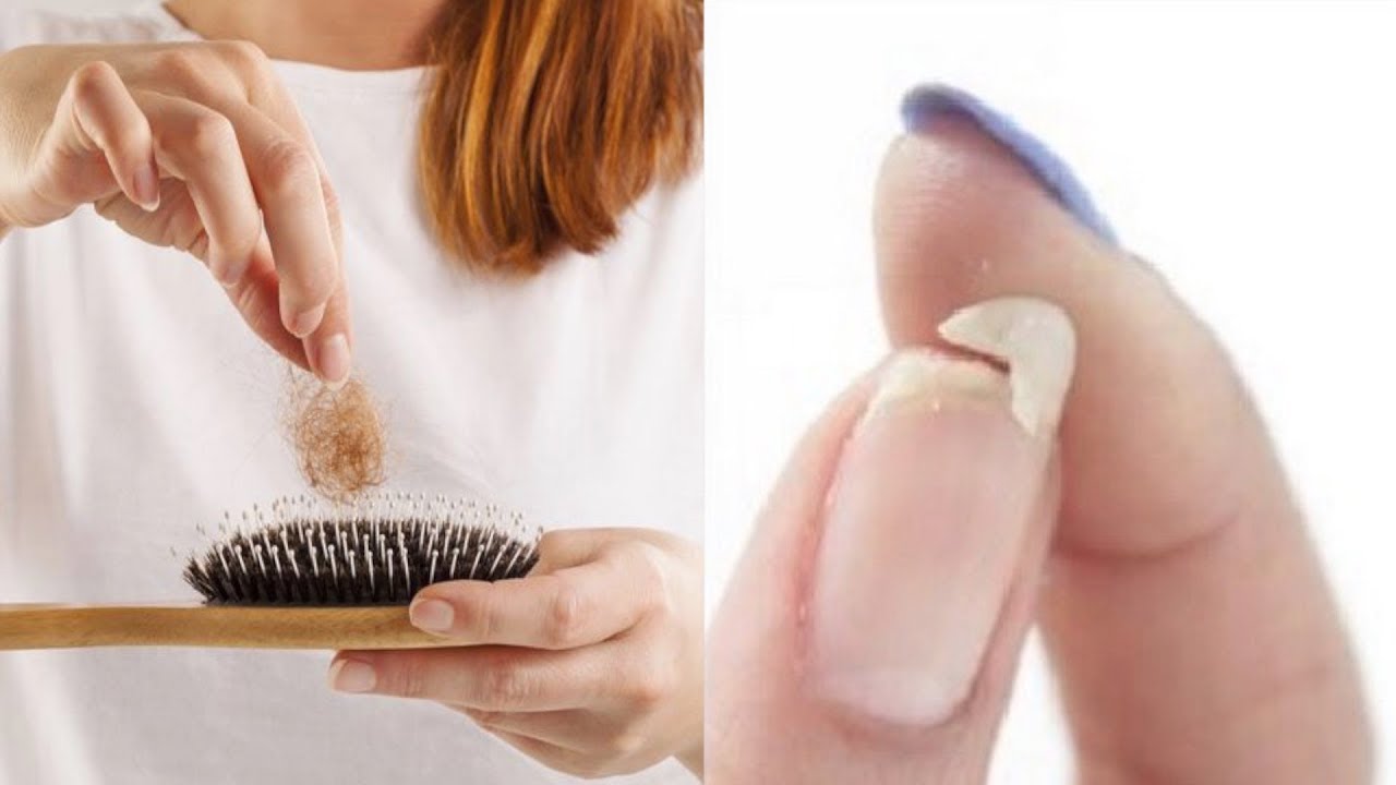You Need to Eat This if You Have Hair Loss Brittle Nails Or You're Not