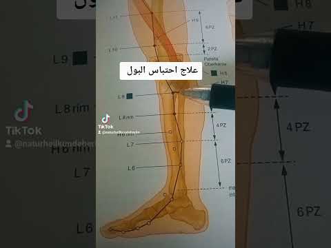 علاج احتباس البول حجامة برلين وثاب عرق النسا ابر صينية ابهر