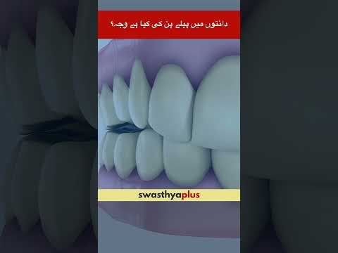 دانتوں میں پیلے پن کی کیا ہے وجہ؟ | Causes of Yellow Teeth | Dr T Ahmed | #Shorts
