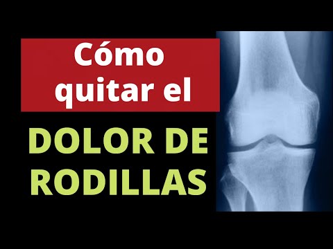 Video: Cómo Quitarse Las Rodillas