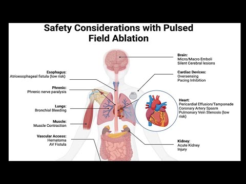 #PFA for Complications