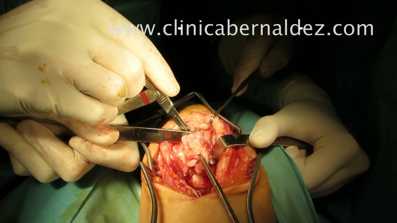 Cuanto dura una operacion en forex