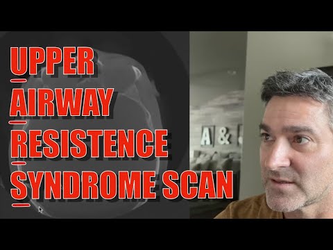Scan For Upper Airway Resistance Syndrome UARS Pre Surgery
