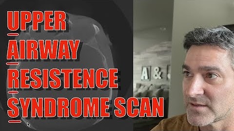 Scan for Upper Airway Resistance Syndrome (UARS)  Pre-Surgery.