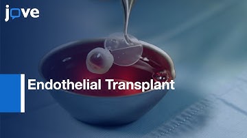 All-laser Endothelial Transplant | Protocol Preview