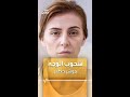 شحوب الوجه مؤشر خطير