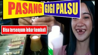 Tambal Gigi Depan Berlubang | Dentist | Dokter Gigi Tri Putra