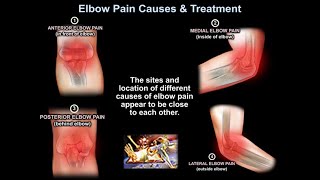 Elbow Pain Causes & Treatment  Everything You Need To Know  Dr. Nabil Ebraheim