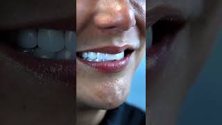 ✨ Amatista Glow ✨ The smile with ternal shine #smilemakeover #smiledesigndental #veneers #dentista