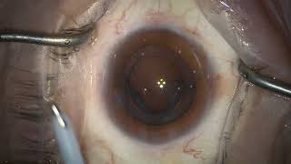 23.10.12 M.63 Od Eyhance 127744